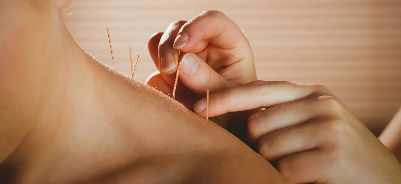 The Best 15 Acupuncture Clinics in Orlando, Florida